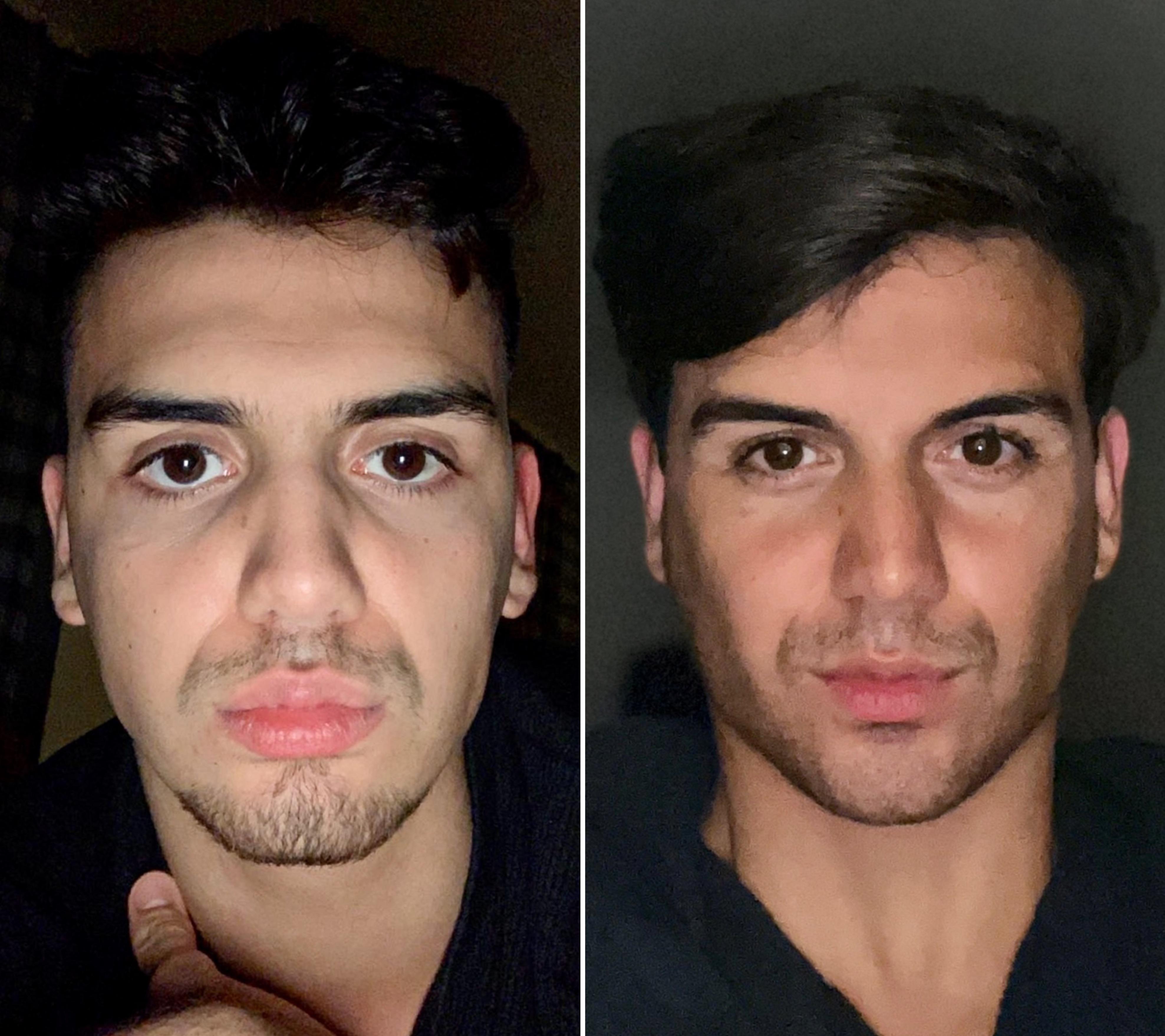 How to Do Mewing: A Guide to Transforming Your Jawline and Facial Structure