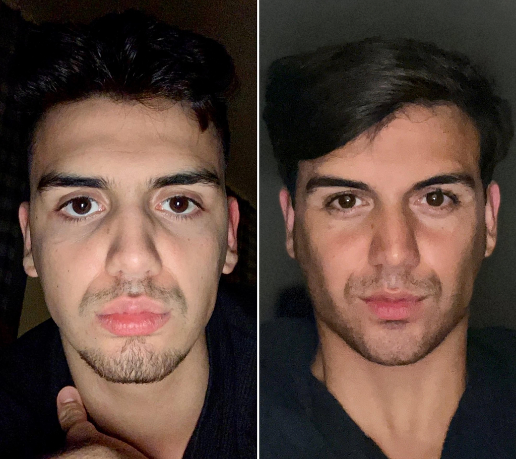 How to Do Mewing: A Guide to Transforming Your Jawline and Facial Structure