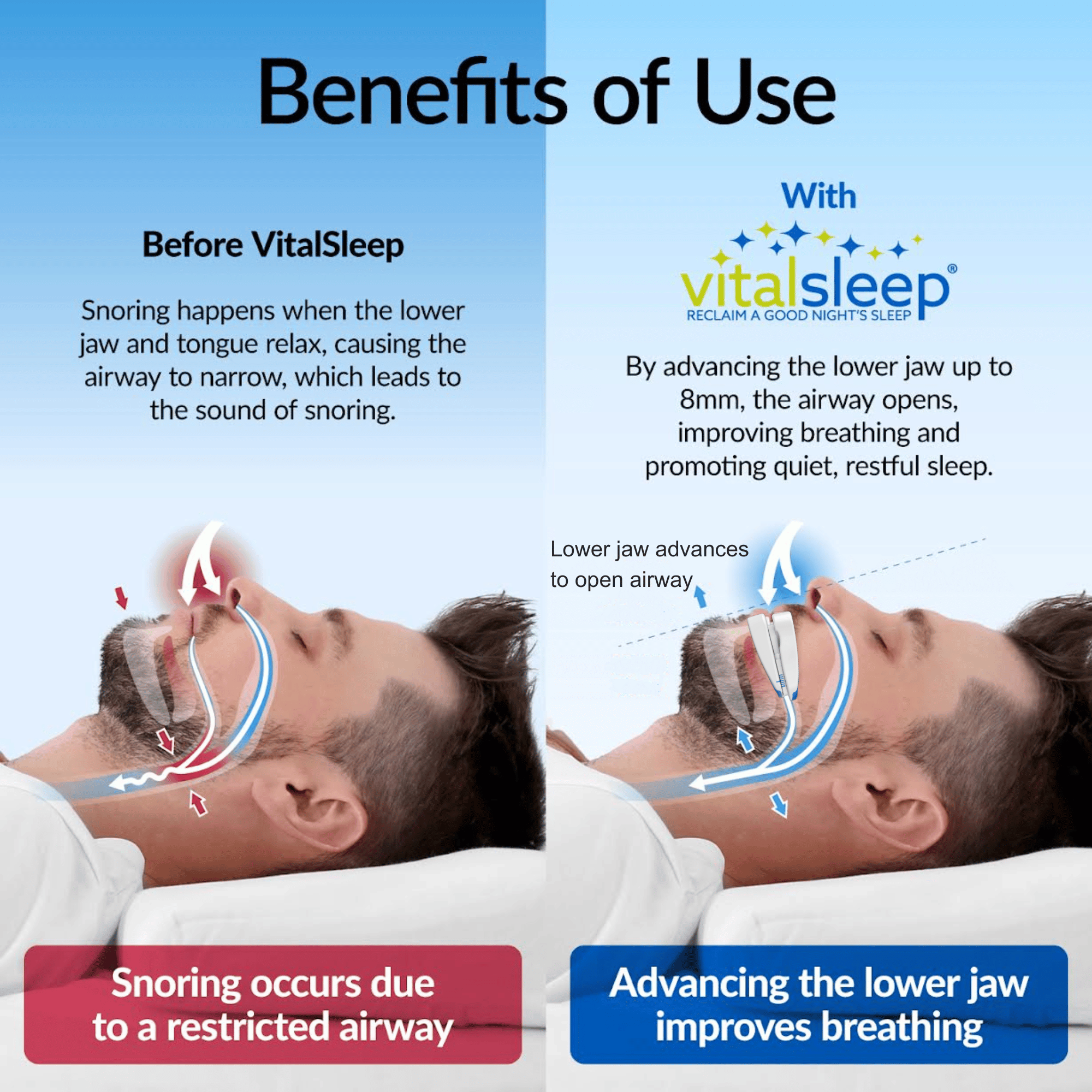 Side view showing VitalSleep's adjustable jaw mechanism