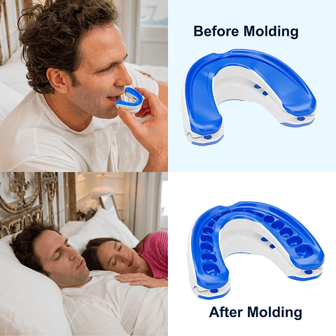 VitalSleep Anti-Snoring Mouthpiece snoring device