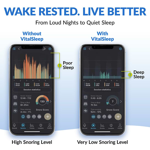 Graph from the Snorlap app showing a user's snoring reduction data after using a snoring mouthpiece