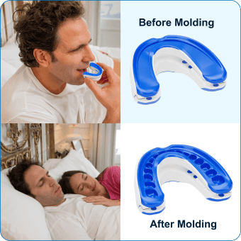 VitalSleep Mouthpiece For Snoring - Save $20