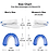 size variations of snoring mouthieces
