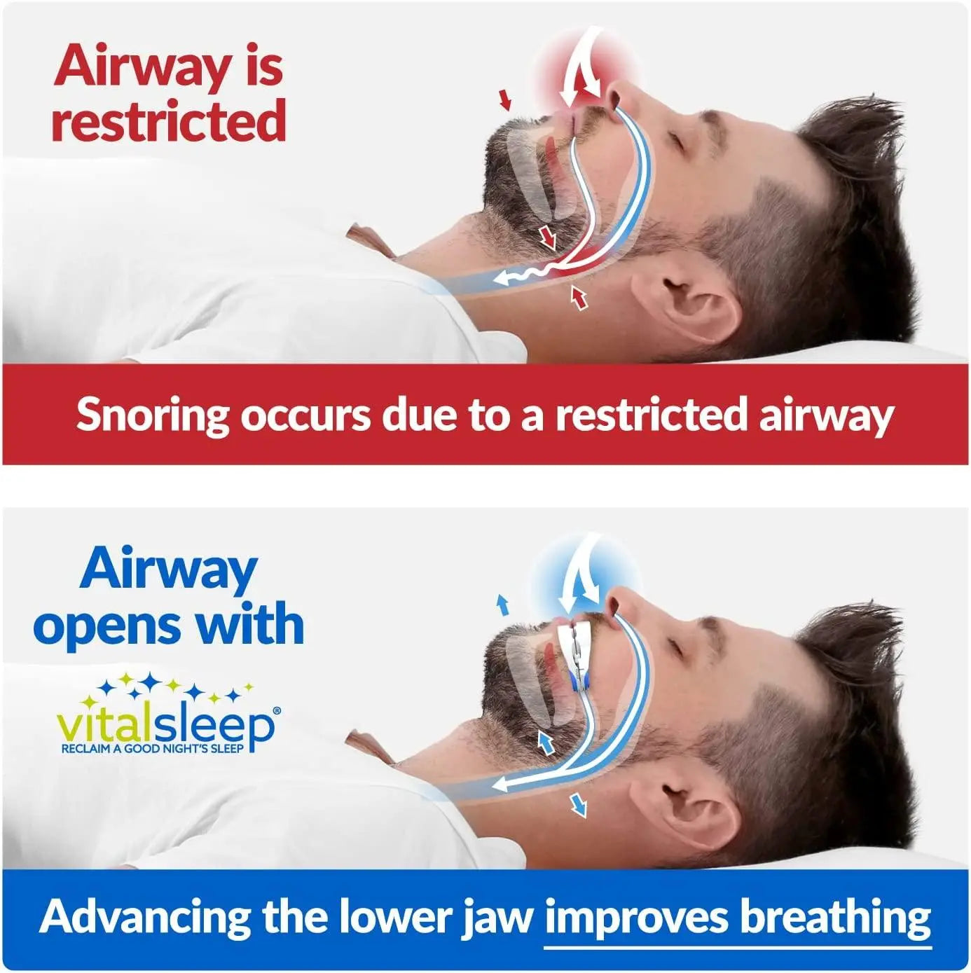 Snoring Mouthpiece DuoPack (2 Pieces) - VitalSleep snoring device