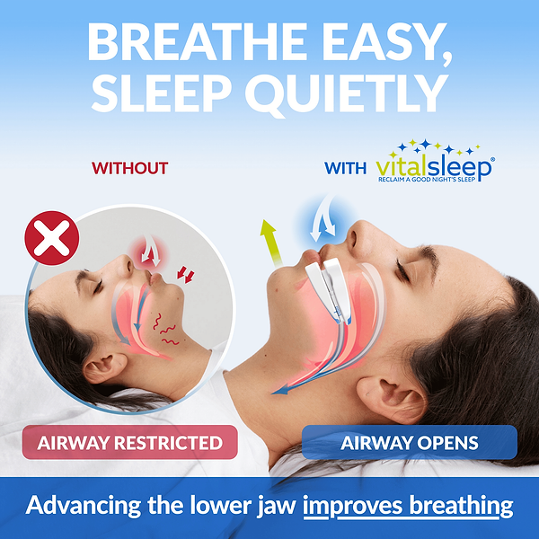 VitalSleep mouthpiece improves breathing, likely used in Amazon marketing