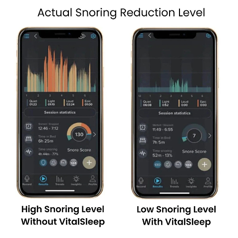 VitalSleep Anti-Snoring Mouthpiece