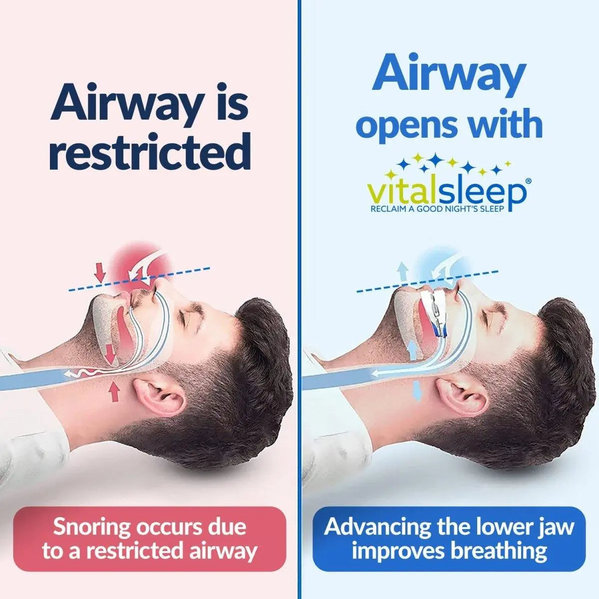 VitalSleep תפסיק לנחור שופר snoring device