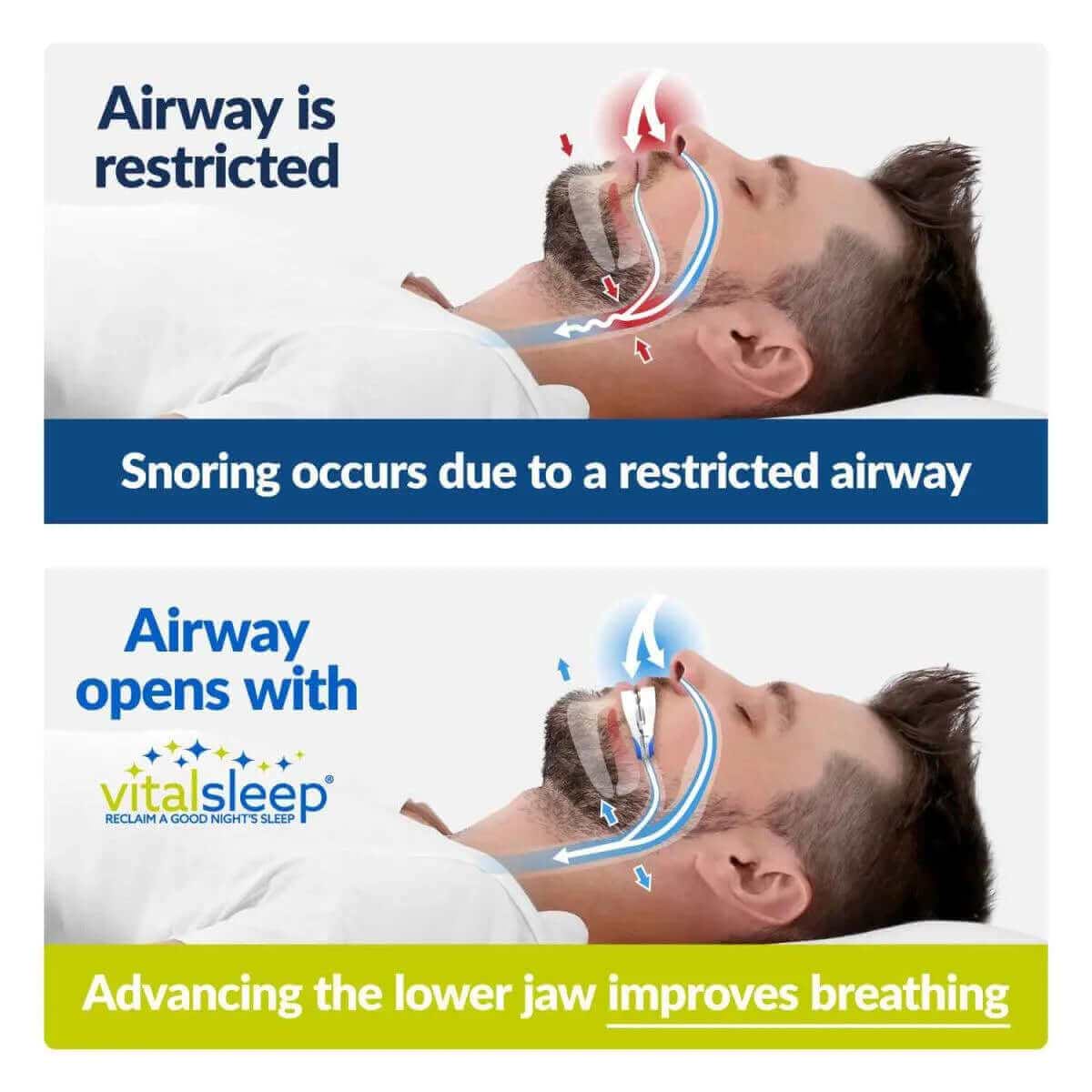 Side view of man sleeping peacefully with VitalSleep