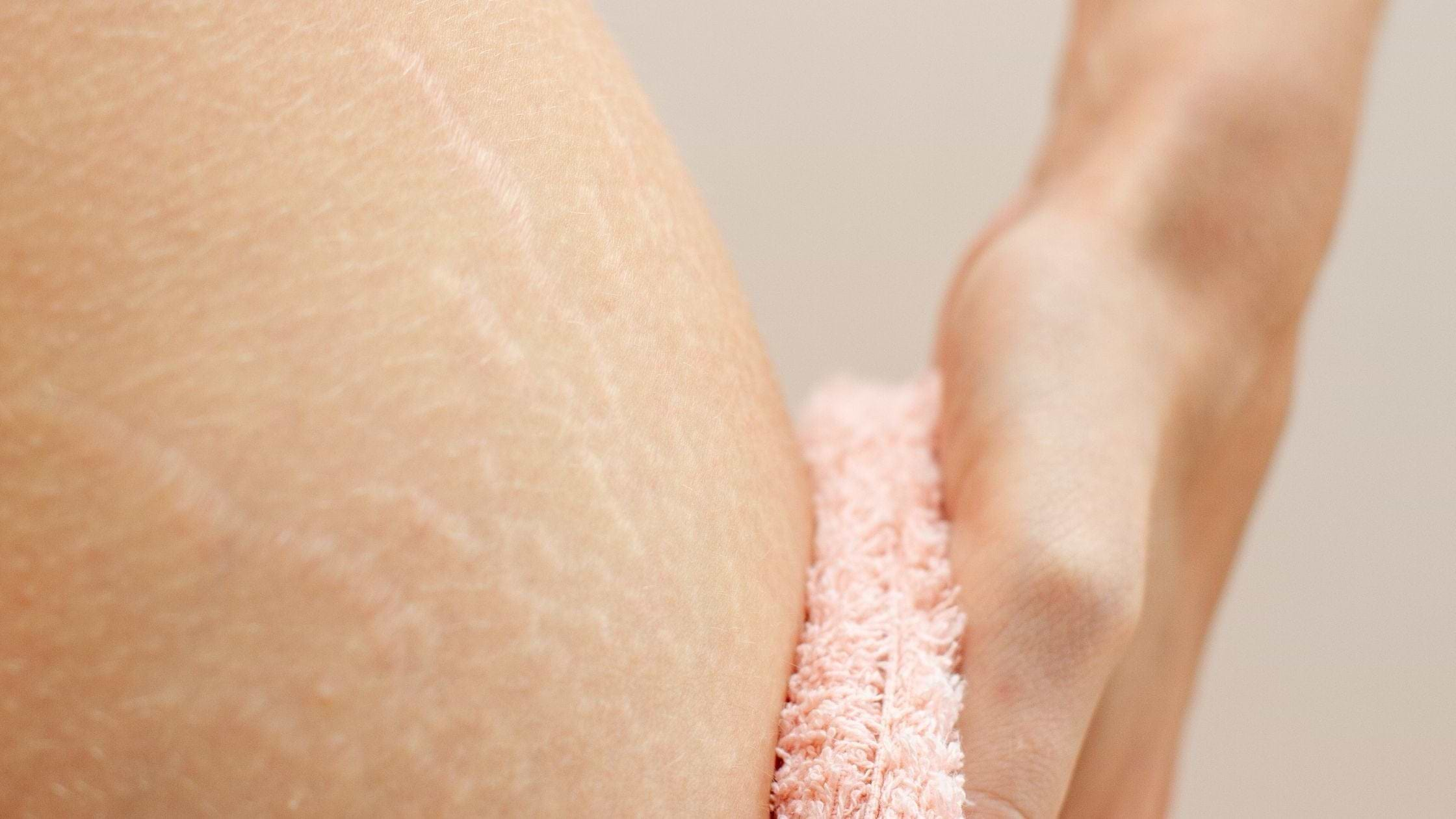 How To Remove Stretch Marks