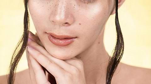 Dark spots on your face: Causes, Treatment and Prevention