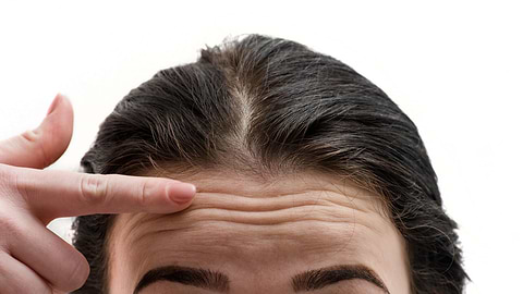 How to Deal with Wrinkles on the Forehead