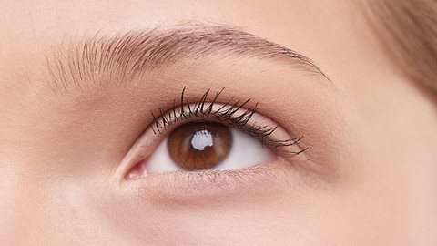 What are fine lines? How to reduce fine lines on the face, around the eyes, and on the forehead?