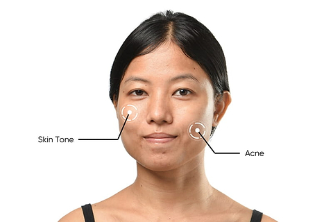 Skin-Analysis-img