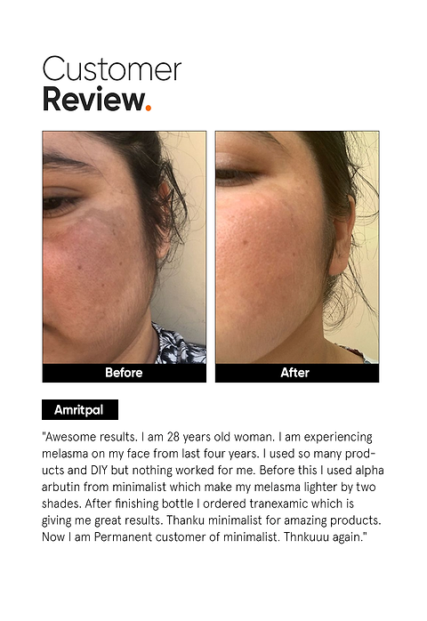 Tranexamic 3% Face Serum