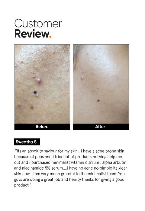 Vitamin C 10% Face Serum