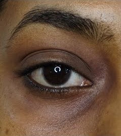 Analyze skin before Dark Circles