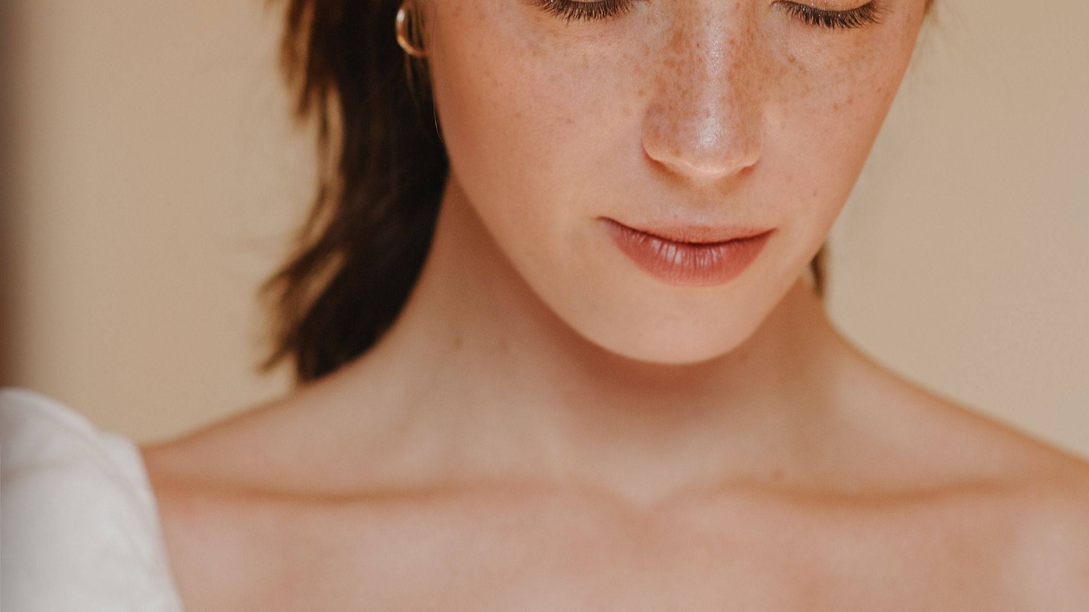 Causes of Melasma and how to treat it