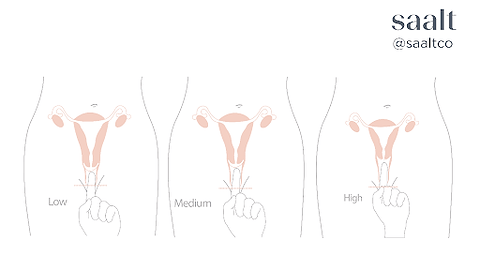 Measuring cervix height