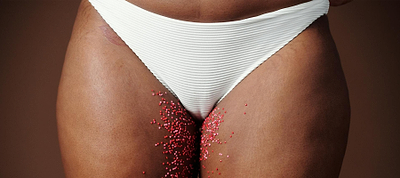 How to Treat Chafing in the Groin Area (Female Guide)