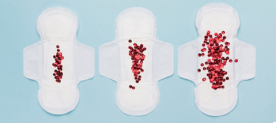 What Causes Blood Clots During Your Period