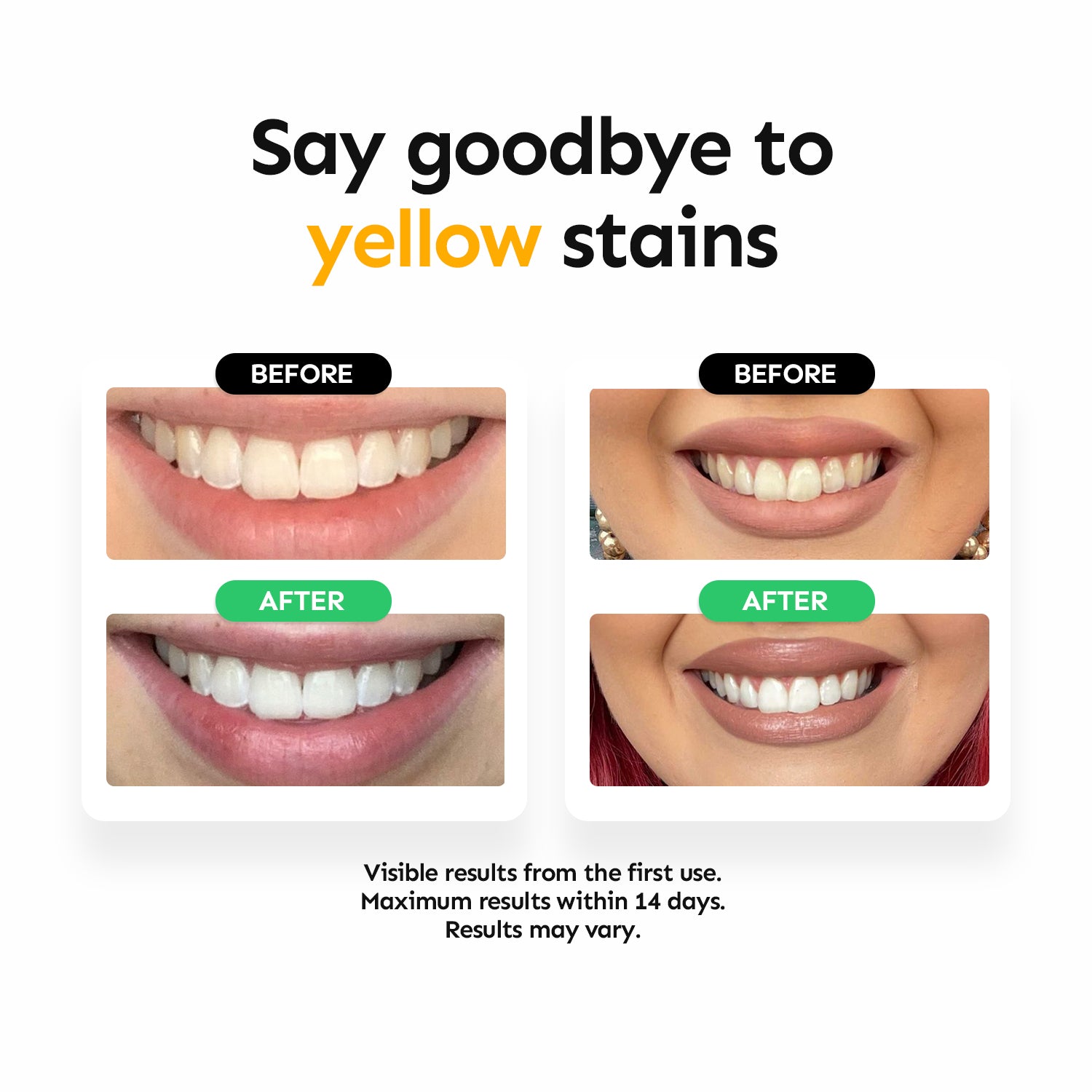 Teeth Whitening Strips – Whites Beaconsfield