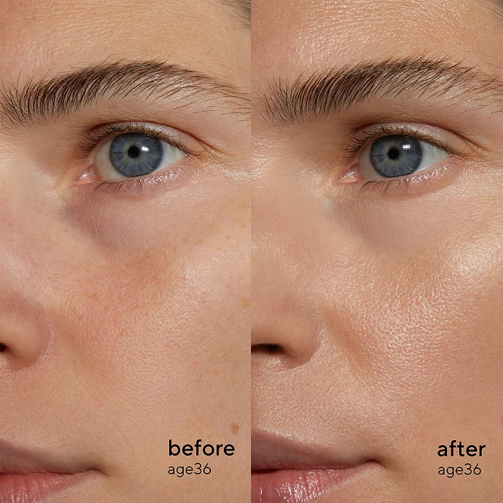 Before and after comparison of using Madara Cosmetics Retinol Alternative Plant-Powered Serum for face