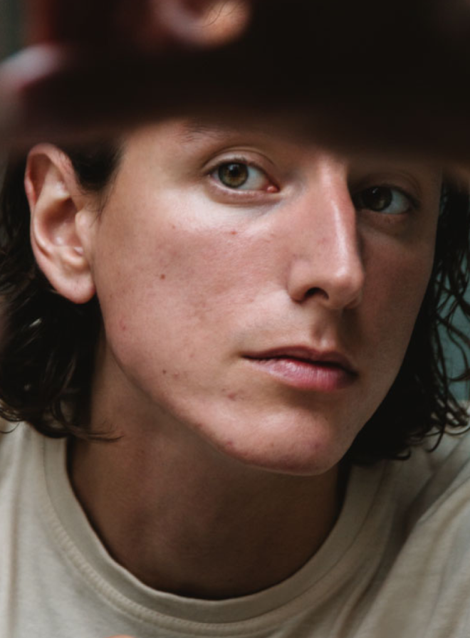 Get Spots Under Control: Your Guide to Acne