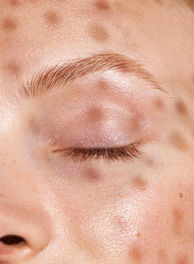 Close-up of a woman’s face with soft shadow patterns across the skin.