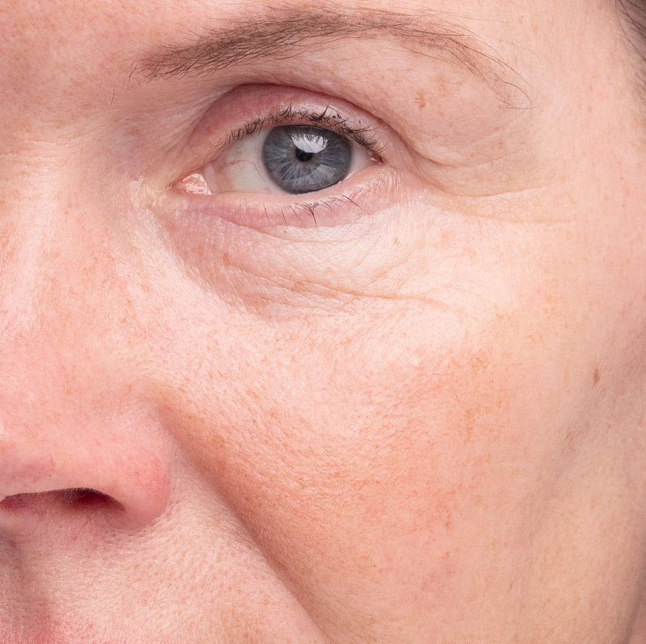 after use of madara age pro line -  Results achieved using the complete Age Pro range together