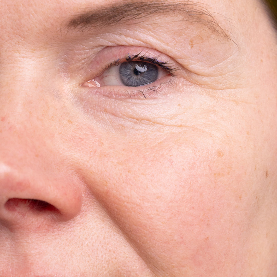 before use of madara age pro line