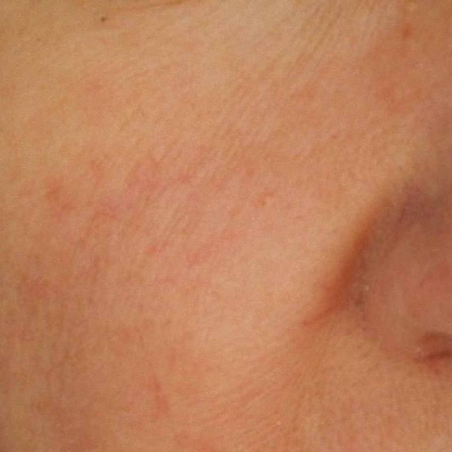 close-up of womans face after using Madara sos + sensitive moisturiser