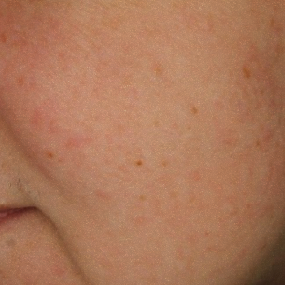 close-up of womans face after using Madara sos + sensitive night cream