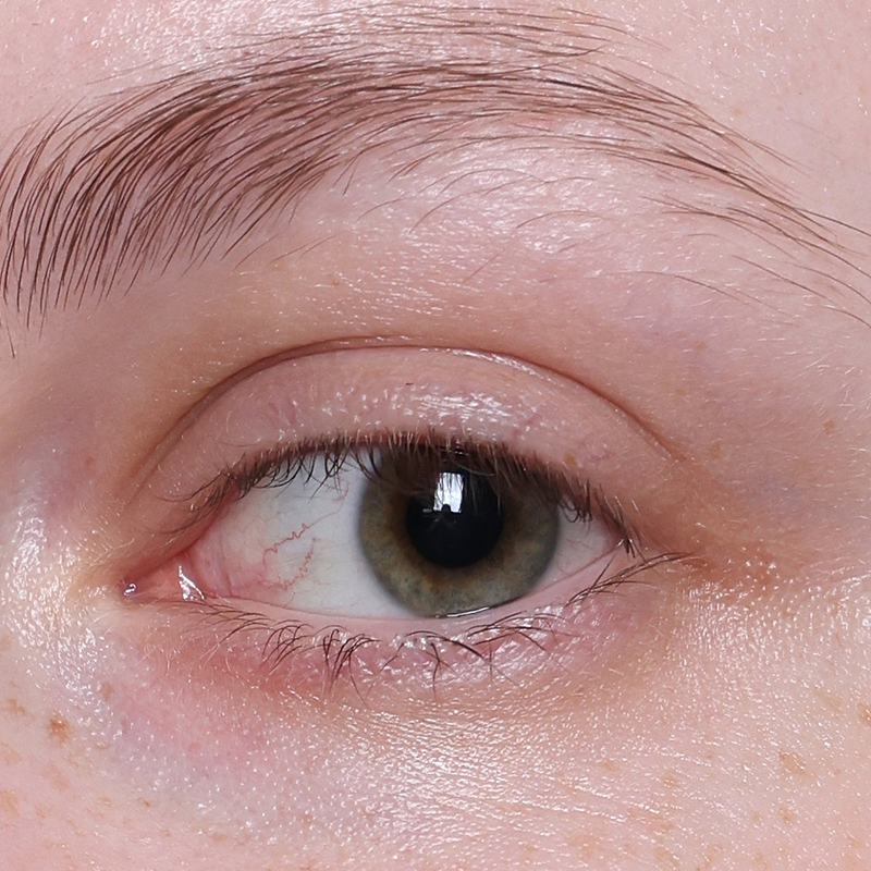 After Application Image