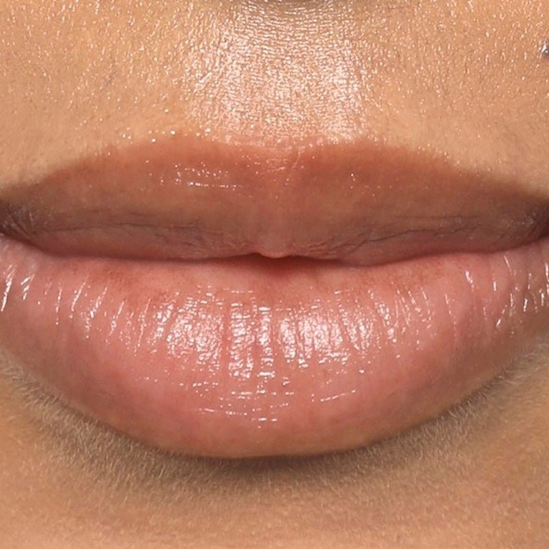 Before Application Image