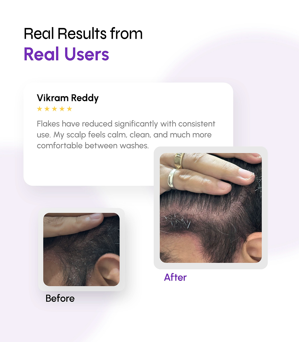 Dandruff Defense with Scalp Renewal Shampoo