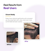 Dandruff Defense with Scalp Renewal Shampoo