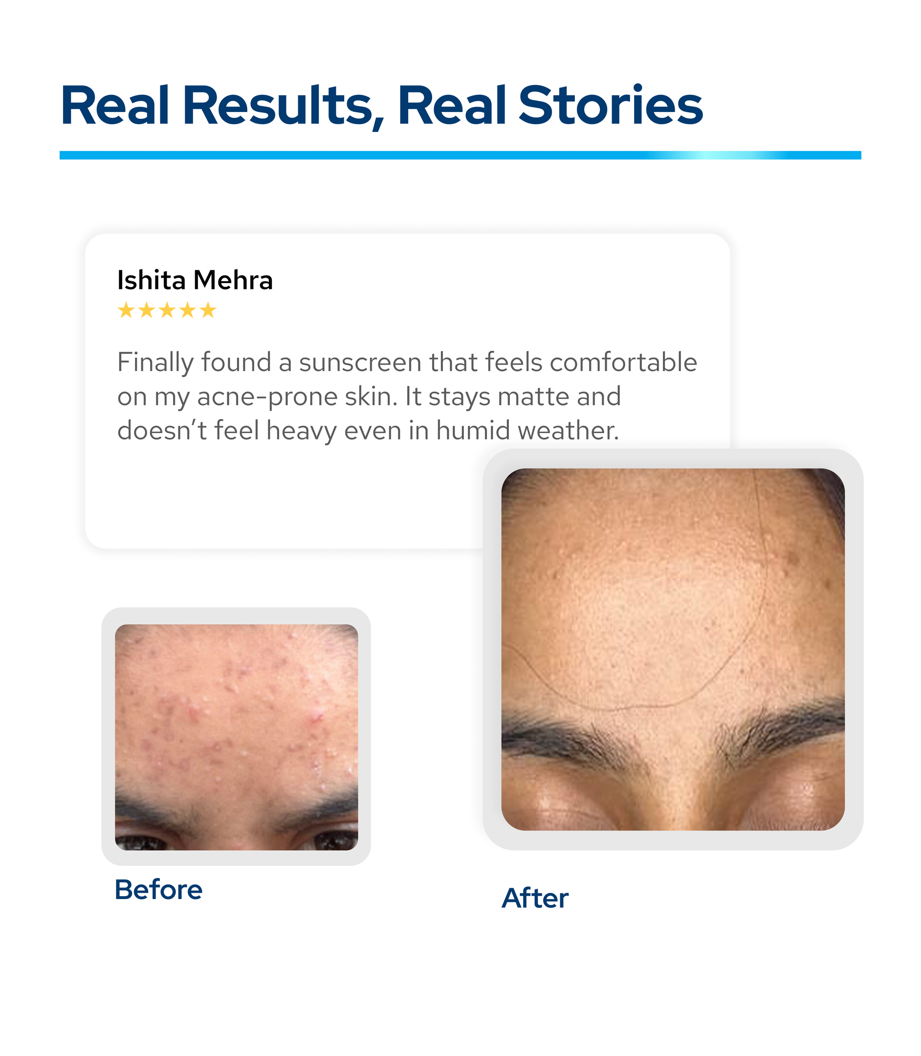 Breakout-Control Sunscreen with Broad Spectrum Shield