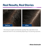 Multi-Action Serum for Flake-Free & Balanced Scalp