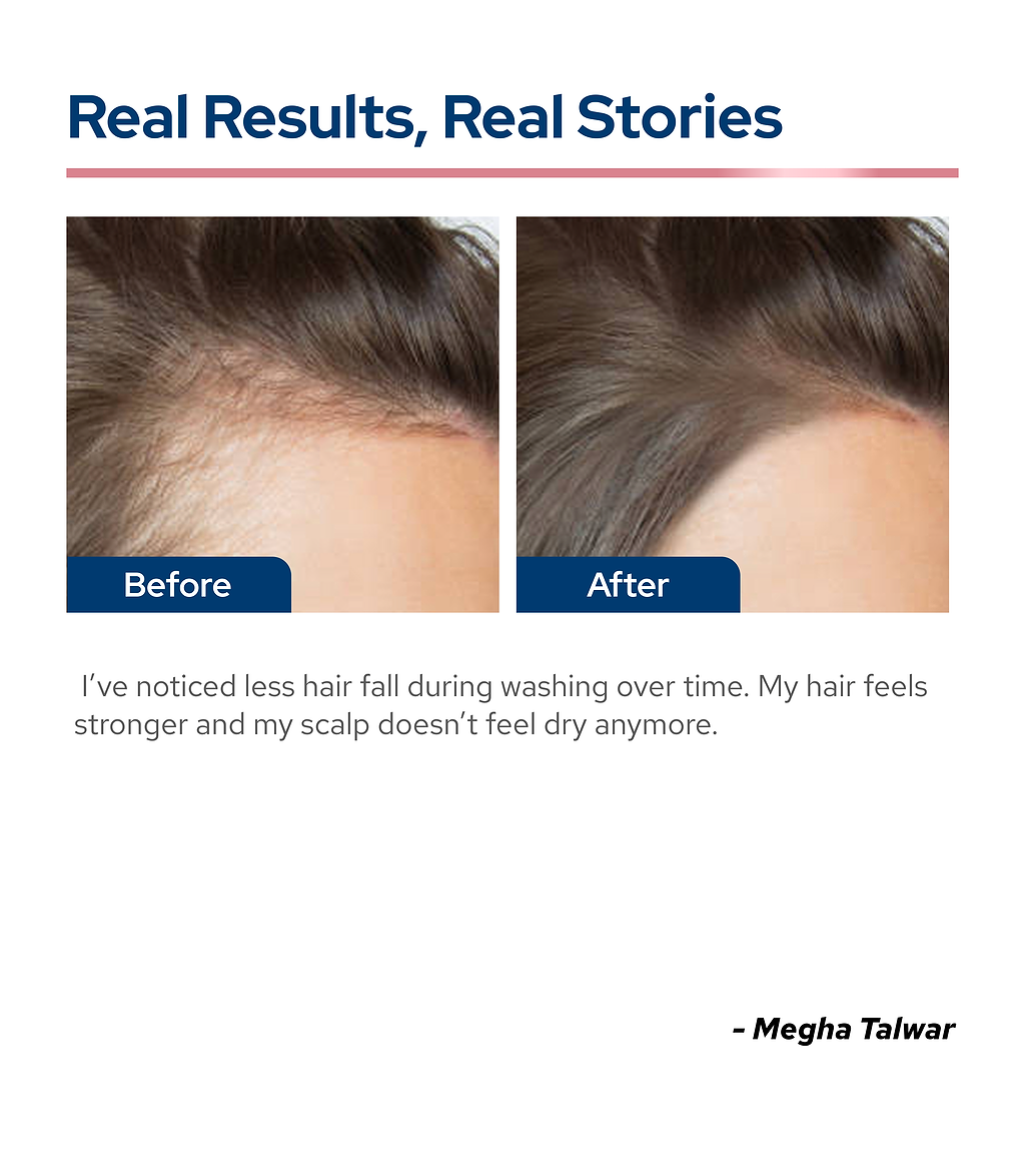 Root-Strengthening Hair Fall Control Shampoo