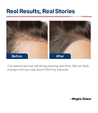 Root-Strengthening Hair Fall Control Shampoo