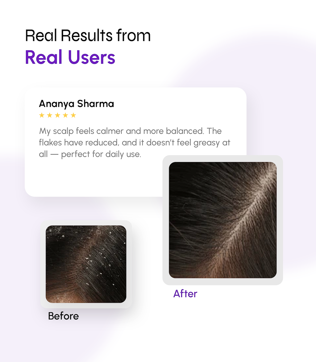 Multi-Action Serum for Flake-Free & Balanced Scalp