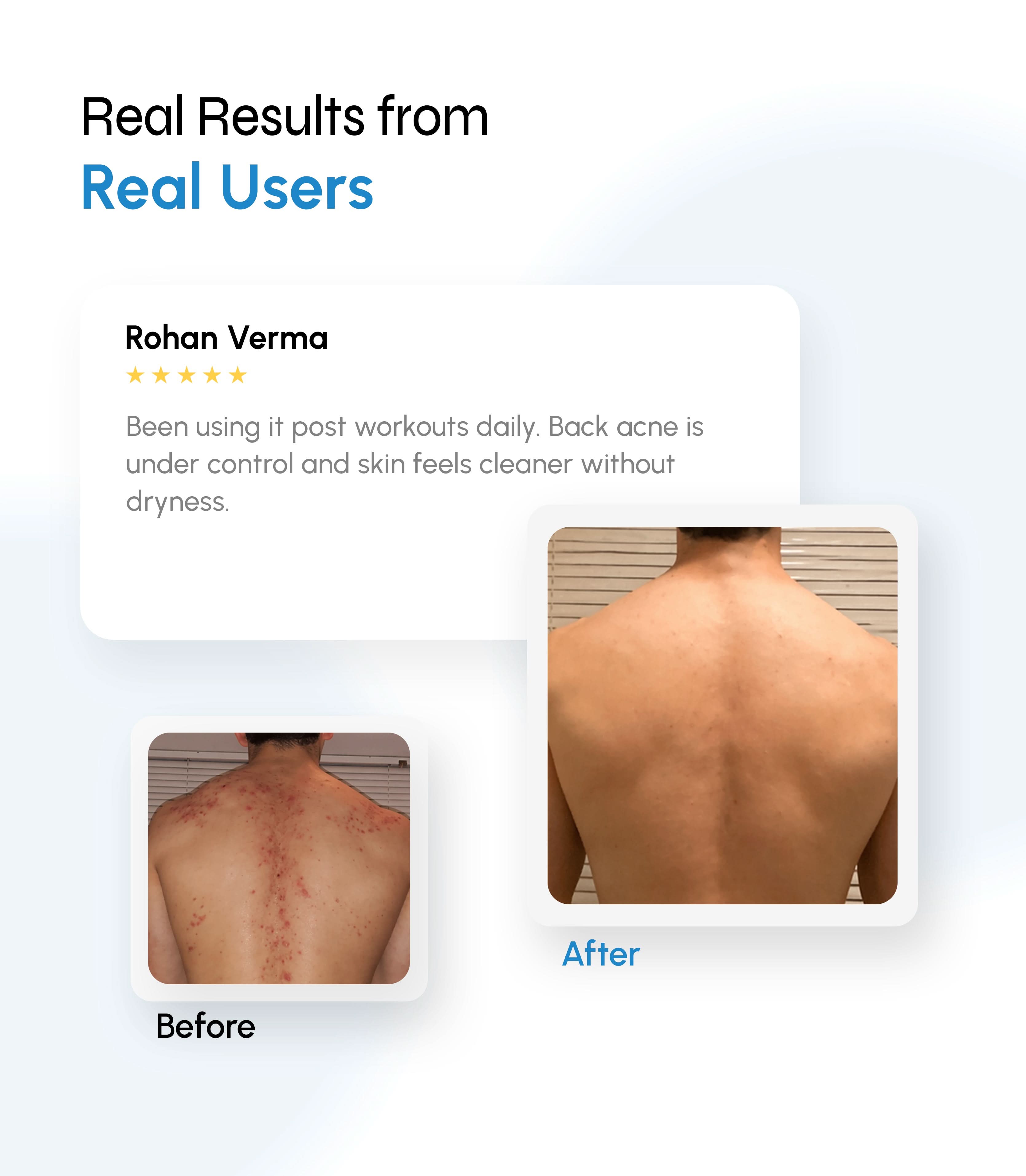Acne Clarifying Serum Body Wash