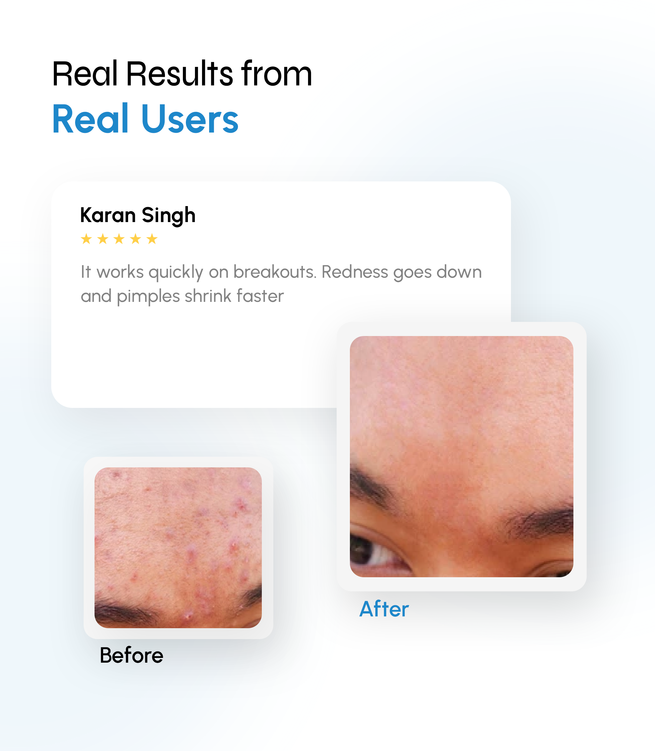 Acne Corrector & Spot Clarifying Gel