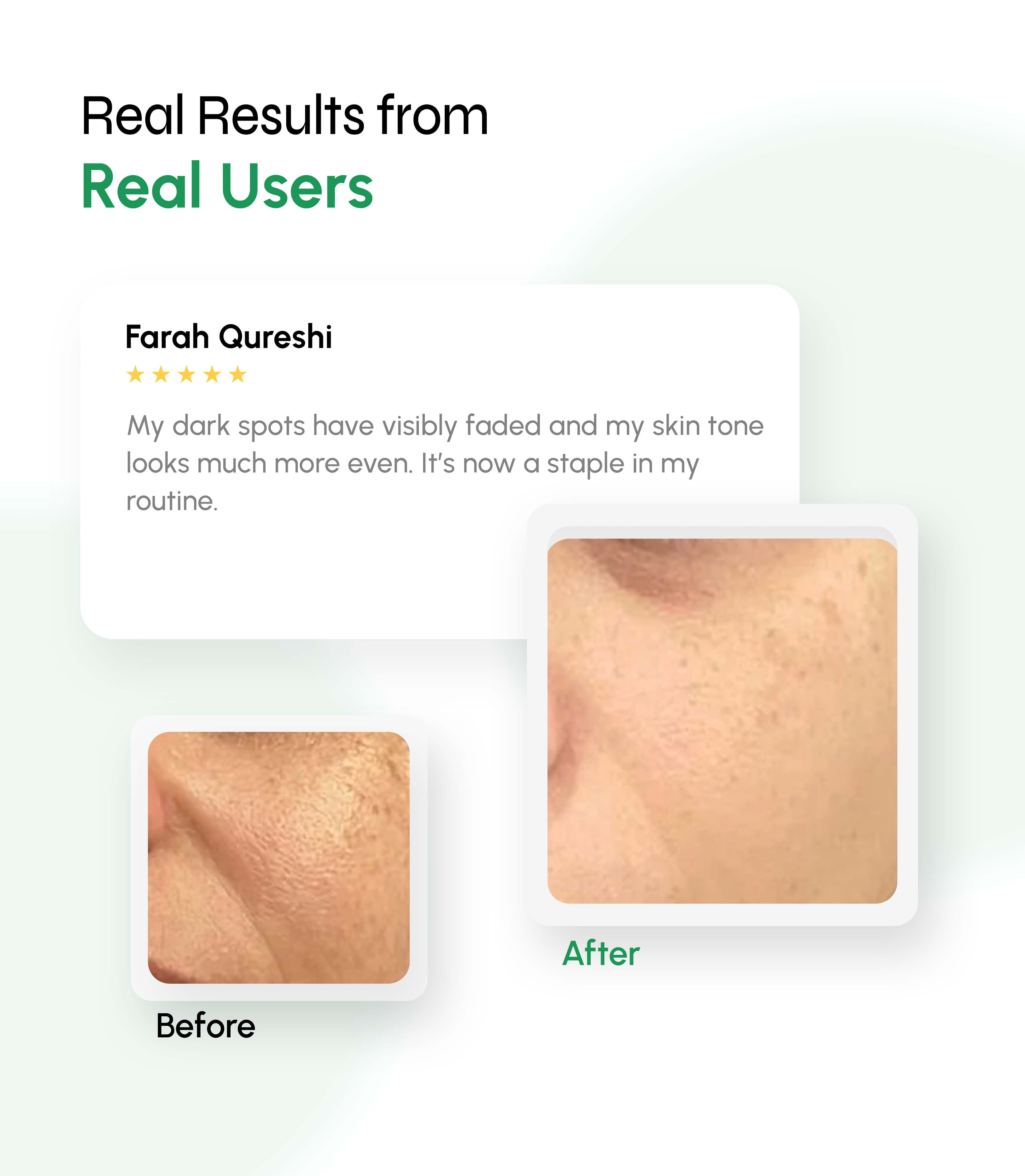 Depigmentation & Spot Correction Serum