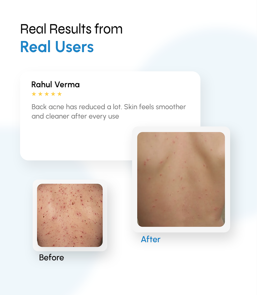 Microclear Exfoliating Bodywash