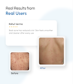 Microclear Exfoliating Bodywash