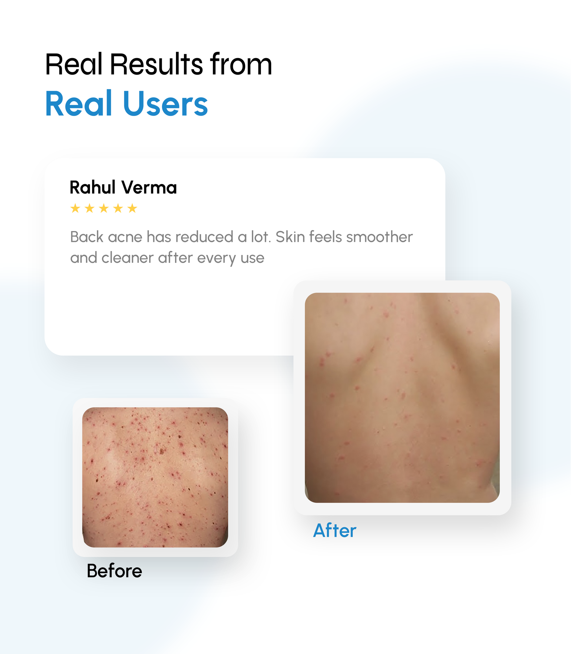 Microclear Exfoliating Bodywash