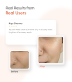 Advanced Brightening Face Cleanser with Hydration & Barrier Support