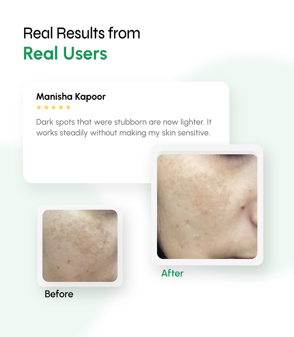 Dark Spot Defense Sunscreen with Tone-Perfecting Actives