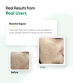 Dark Spot Defense Sunscreen with Tone-Perfecting Actives